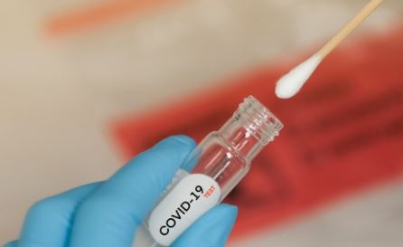 838 са новите случаи на COVID 19 у нас Това отчитат здравните